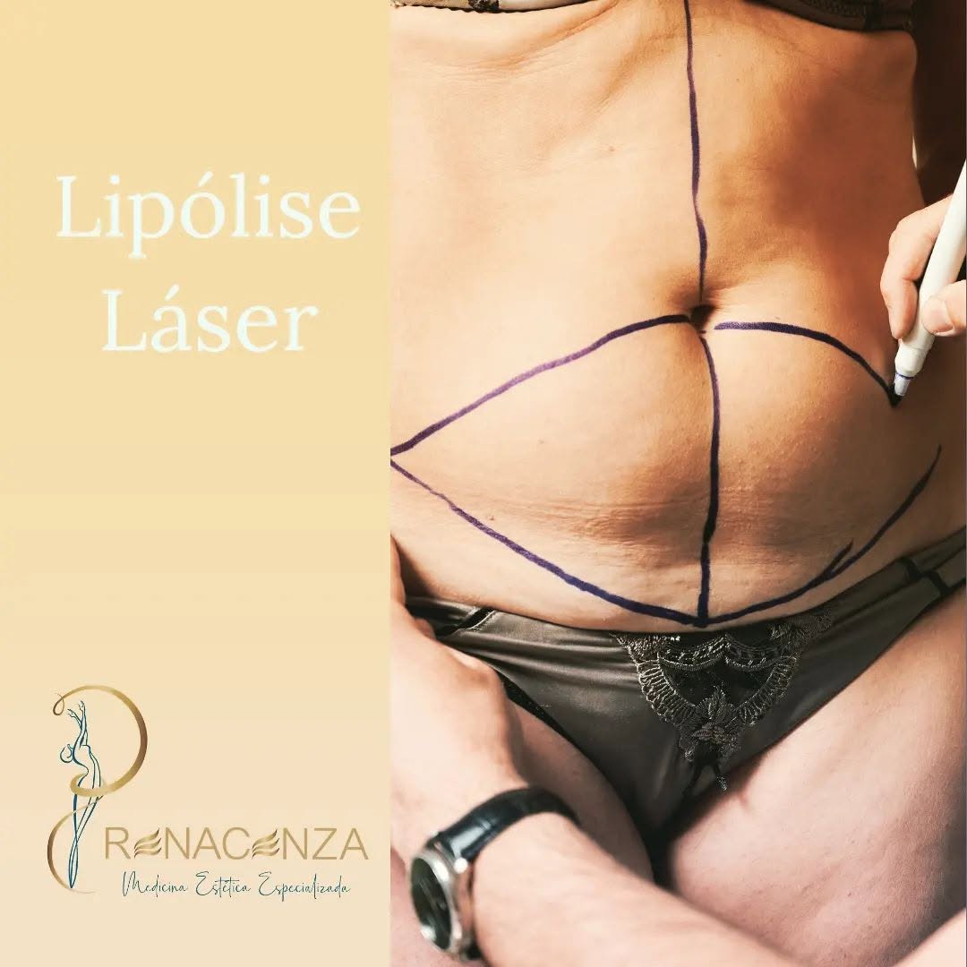 Tratamento de lipólise laser
